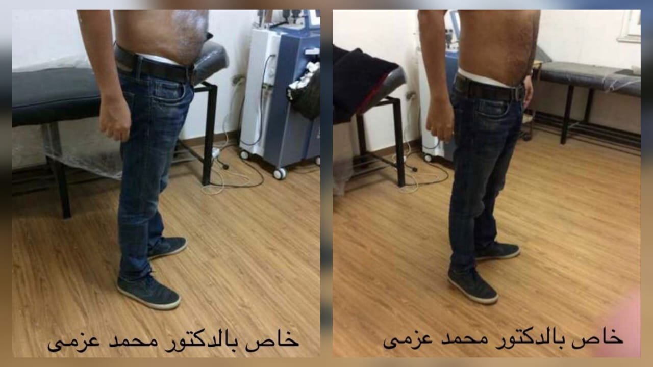 بعض الحالات قبل و بعد - محمـــــد عزمـــــي