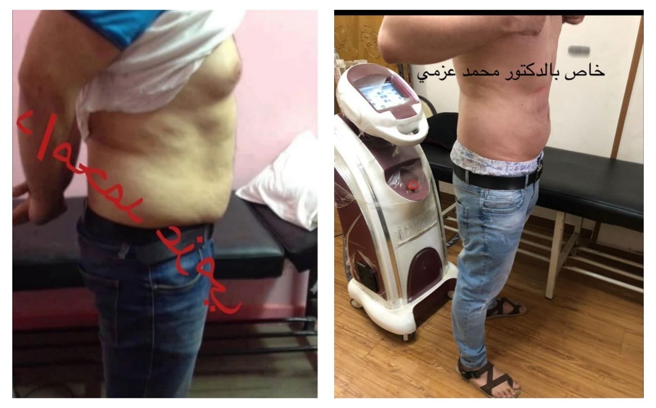 بعض الحالات قبل و بعد - محمـــــد عزمـــــي