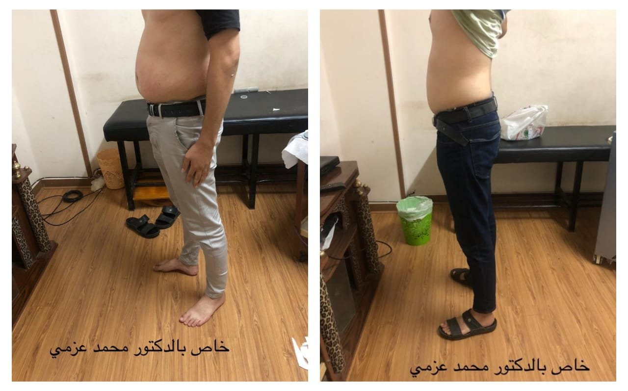 بعض الحالات قبل و بعد - محمـــــد عزمـــــي