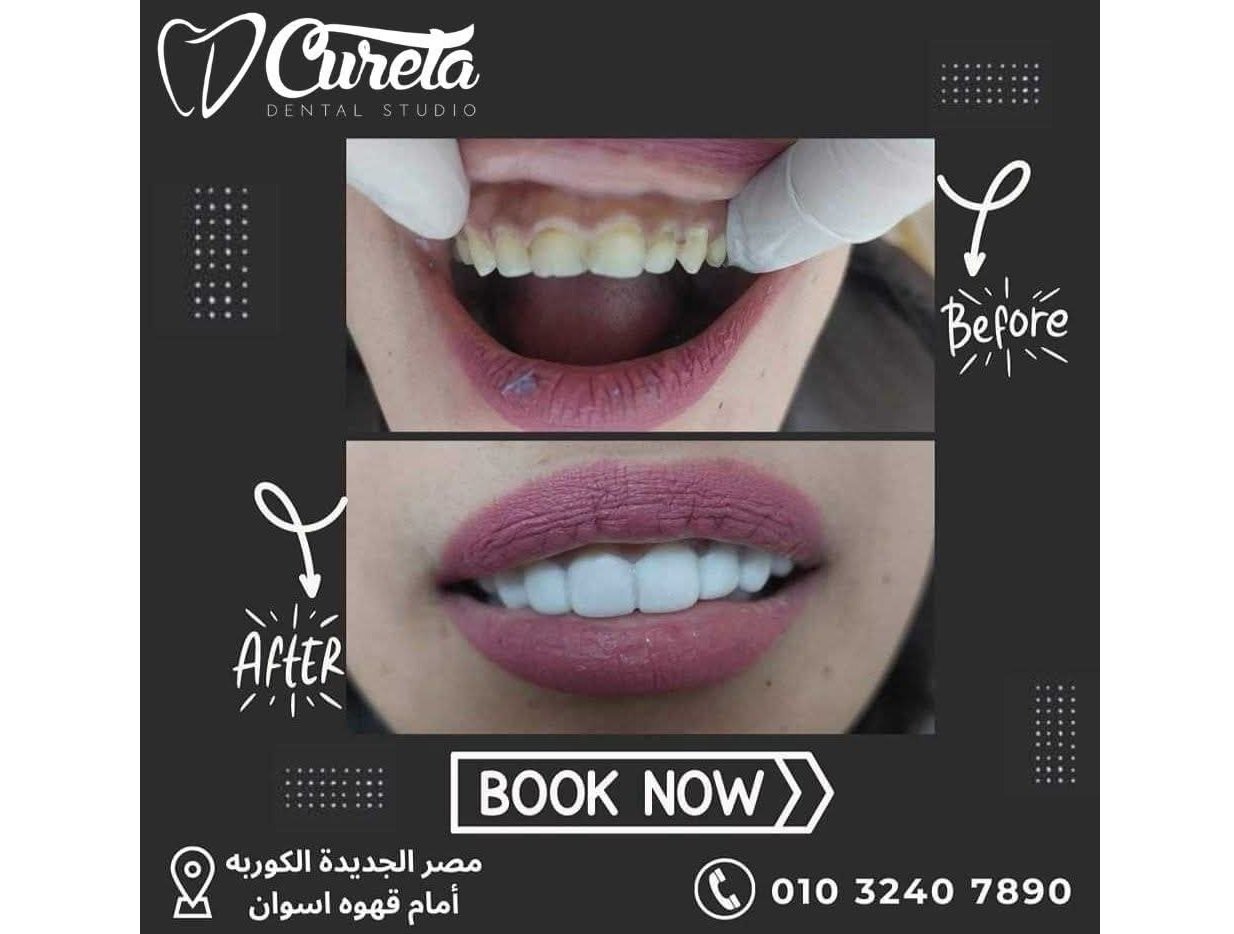 بعض الحالات قبل و بعد - حسام الشامي